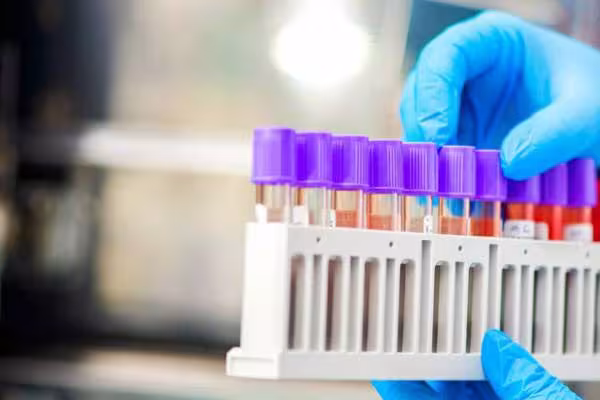 146 nouveaux cas de Coronavirus sont enregistrés en Arménie  