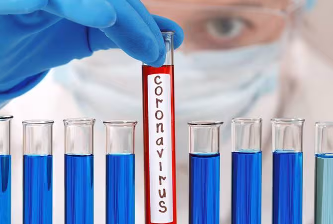 Coronavirus : trois nouveaux cas confirmés en Arménie