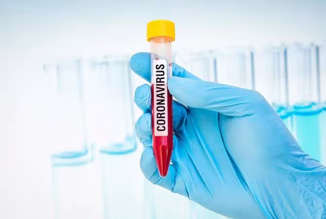 523 nouveaux cas de coronavirus en 24 heures