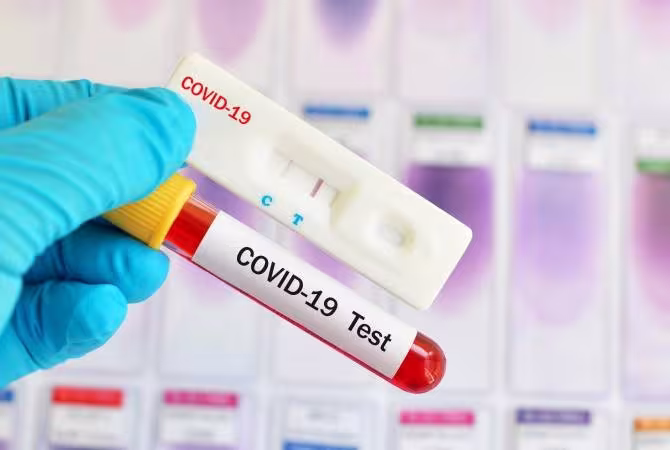 Augmentation de la fréquence des tests PCR